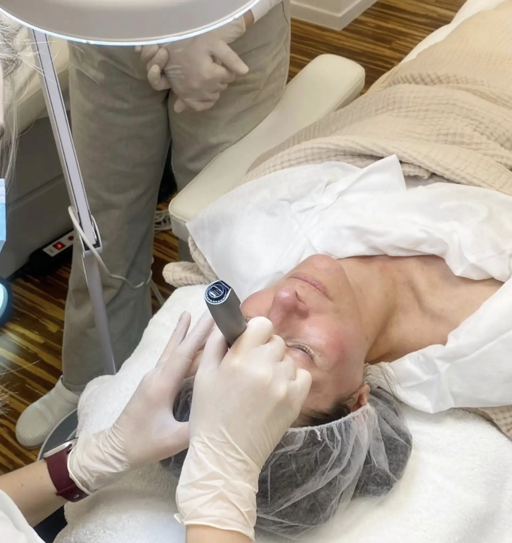 how often should you do skin needling