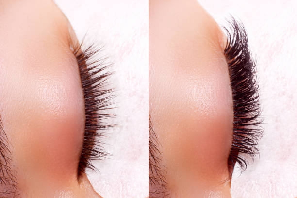 Before and after results of a lash lift and tint treatment - is it worth it?