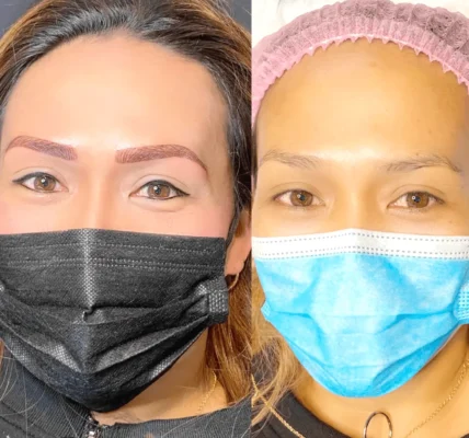 saline tattoo removal melbourne